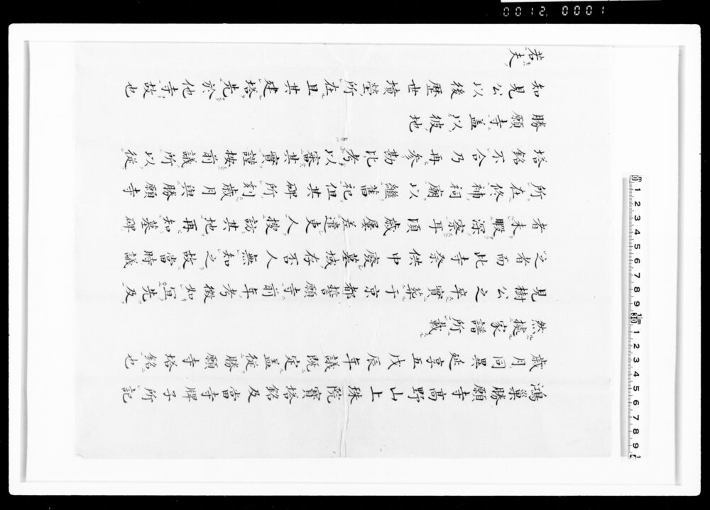 肝臓移植を待っている