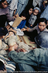 作品画像:全身にやけどを負った戦場の子ども。戦争は木を家を街を、そして、いたいけな子さえも焼く