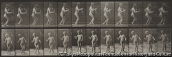 作品画像:水頭症の歩く男性