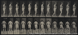 作品画像：硬化症の歩く少女