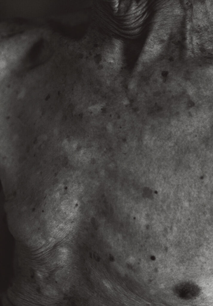 作品画像：＃1『1906 to the skin』より
